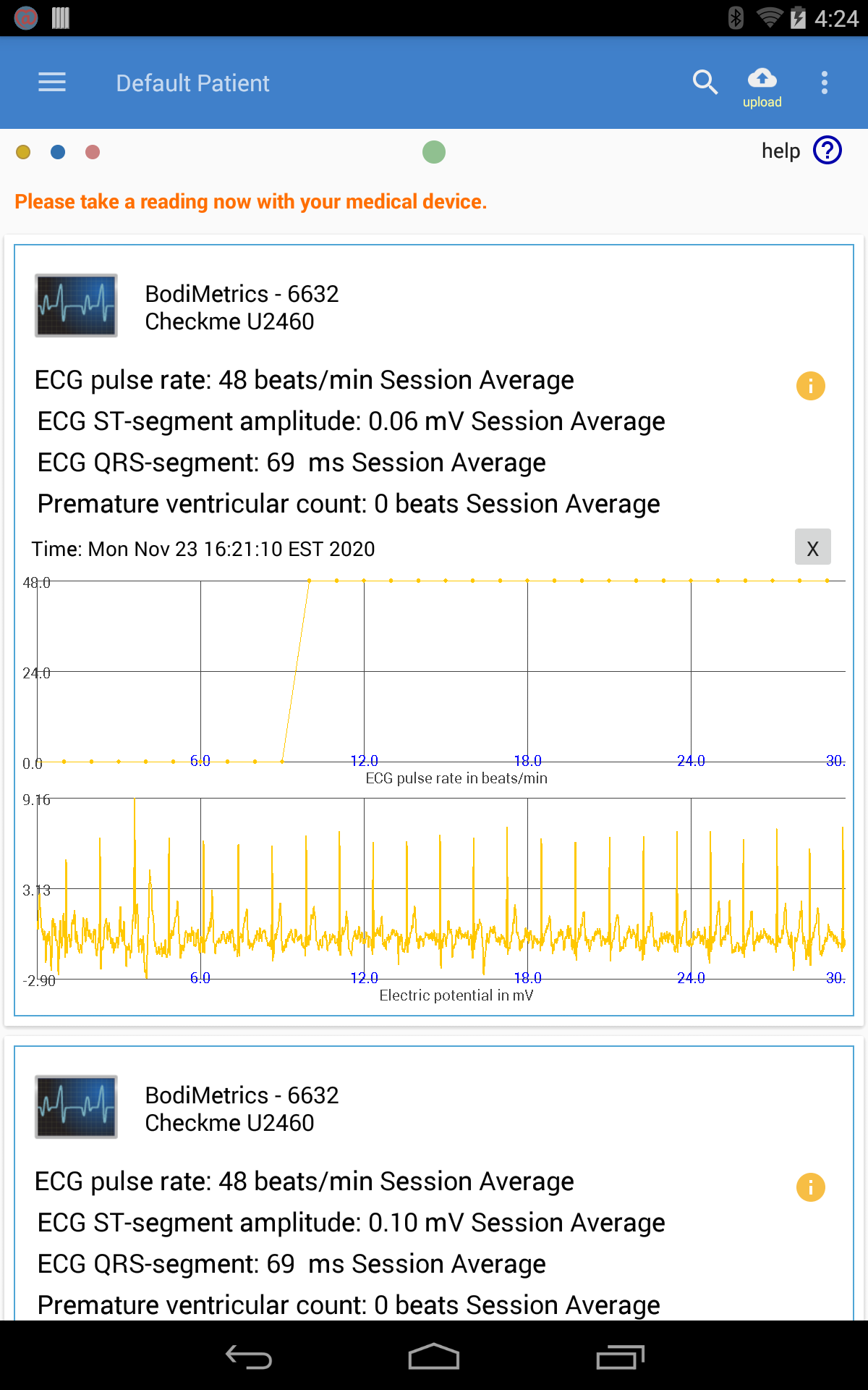 ecg7